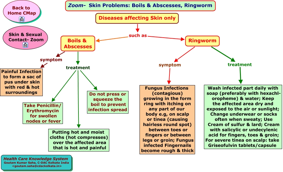 Top 10 Natural Remedies to Treat Ringworm at Home - Cure