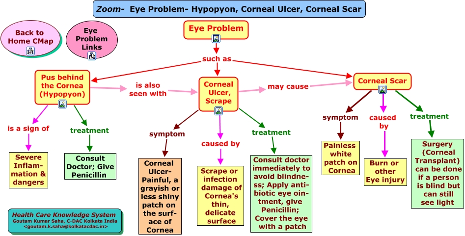 Corneal Ulcer Eye Patch